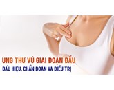 Thuốc mới cho bệnh ung thư vú giai đoạn đầu